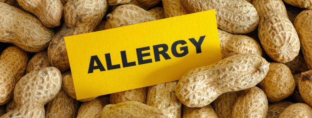 Аллергия на орехи